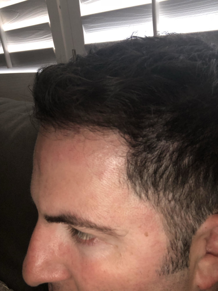 Right Side Of Scalp Hurts