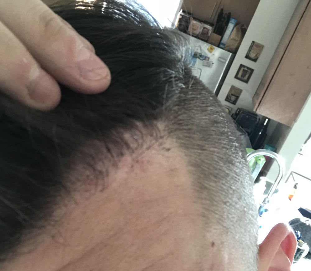 LeftSide PreTP3_1.png