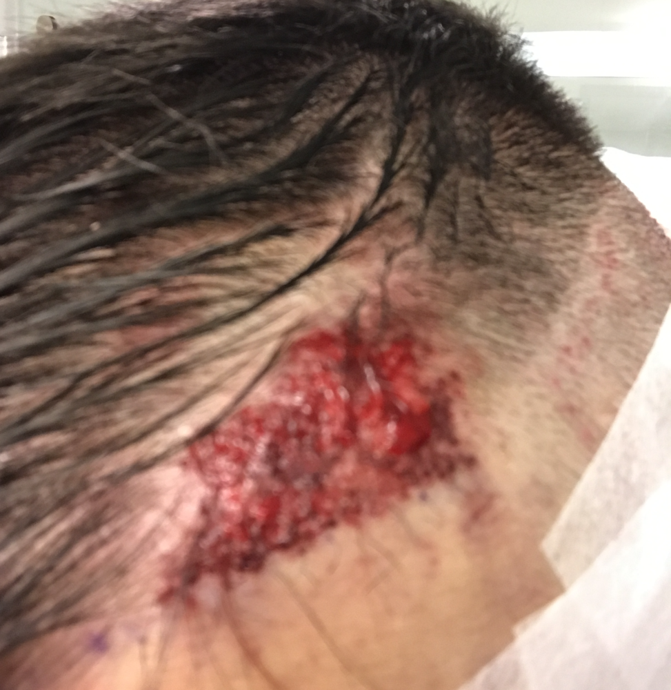 LeftSide Revision day1.png