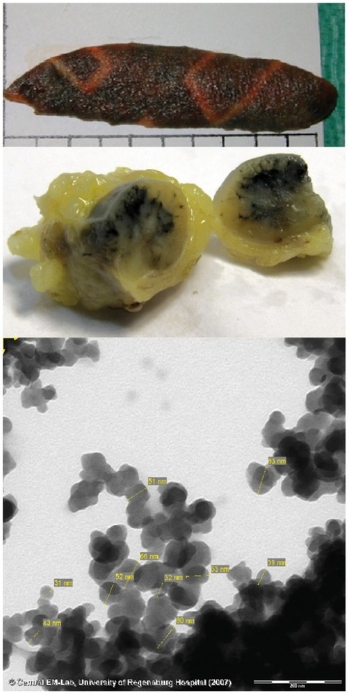 lymph%20node%20with%20ink_zpsrhsq8cbl.jpg