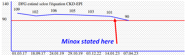 minox_baisse.png.ae28f14251759a731a7bf01fde719a9c.png