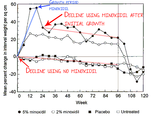 minoxidil-long-term-01.gif