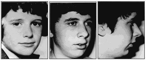 mouth-breathing-boy-face.jpg