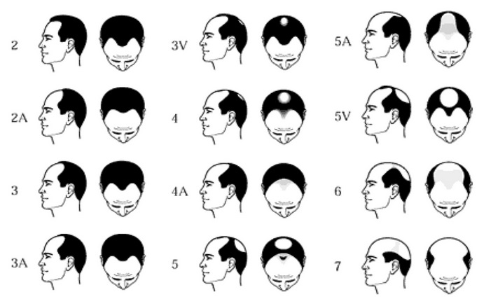 norwood-scale.jpg