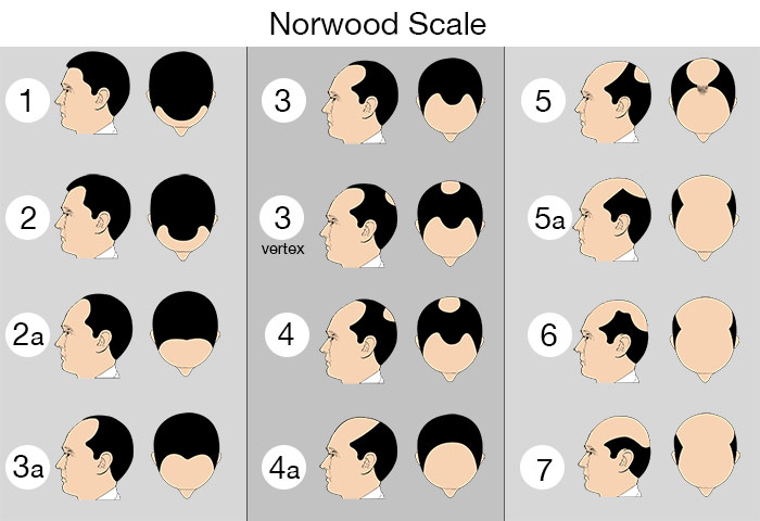 norwoodscale.jpg