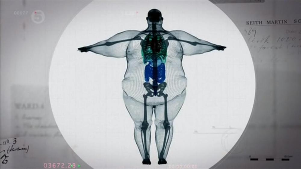 obese-xray.jpg