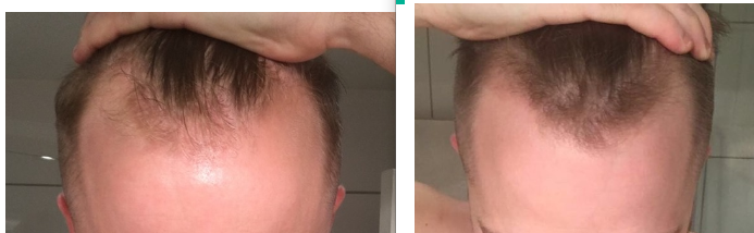 Progresjon 2 mnd minox2.png