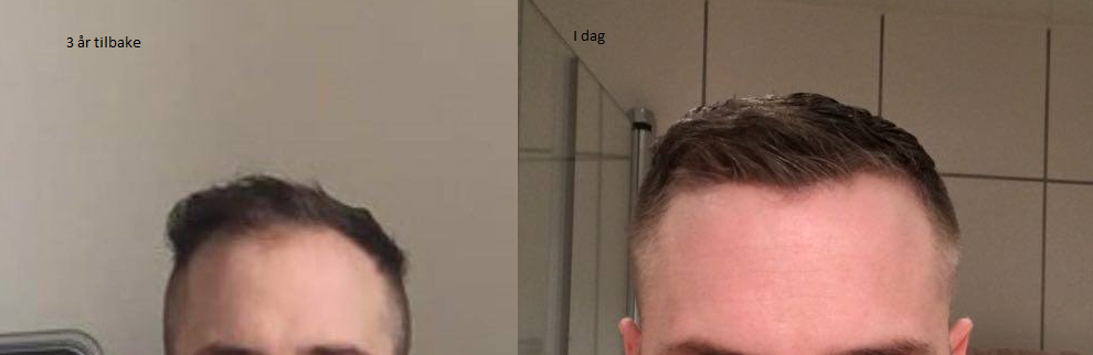 Progresjon.png