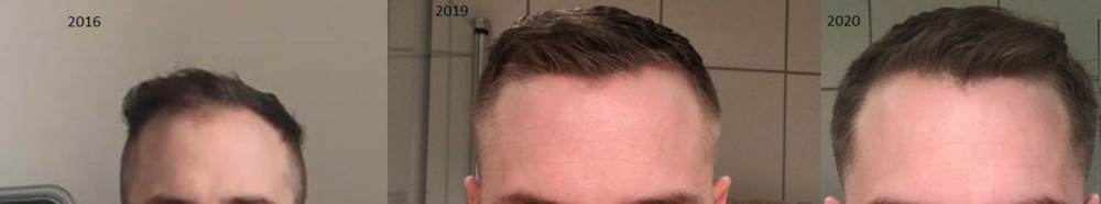 Progression2.png