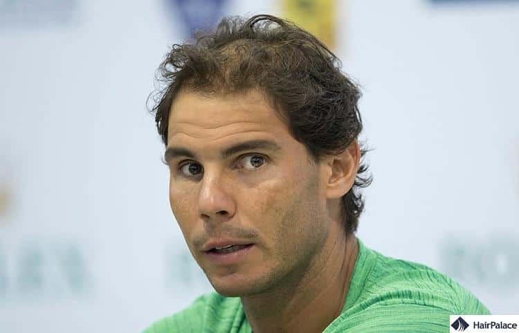 rafael-nadal-balding.jpg