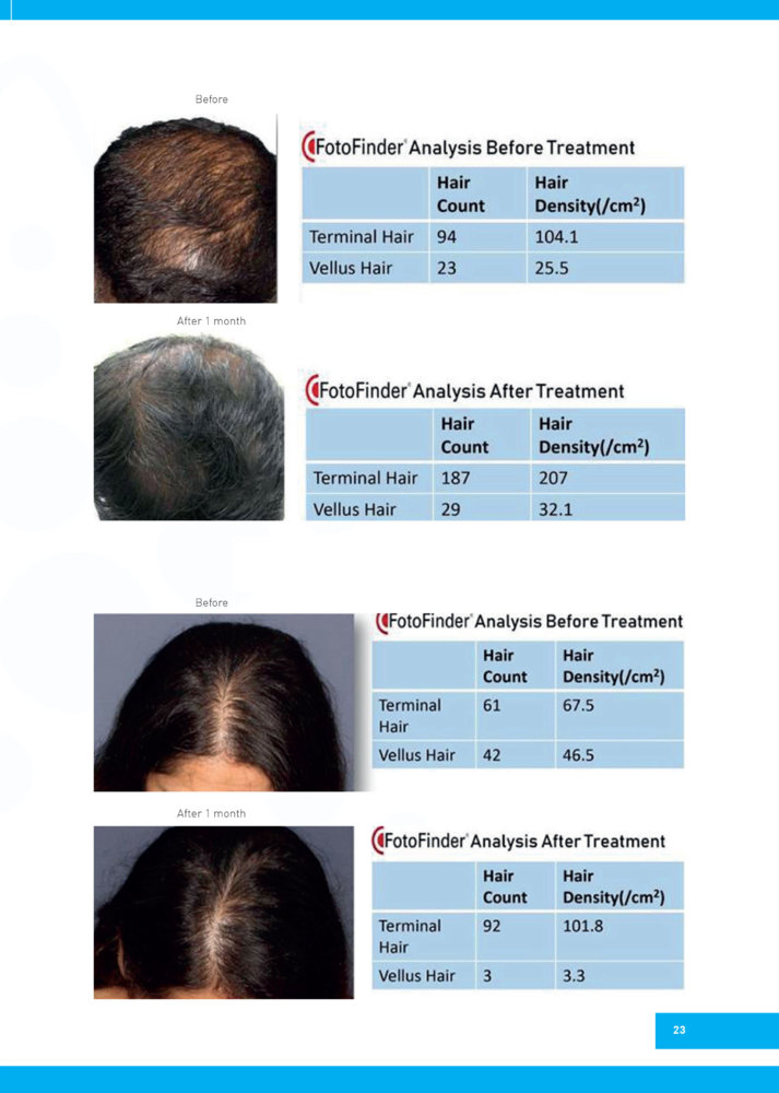 Regenera-Activa-before-after-2.jpg