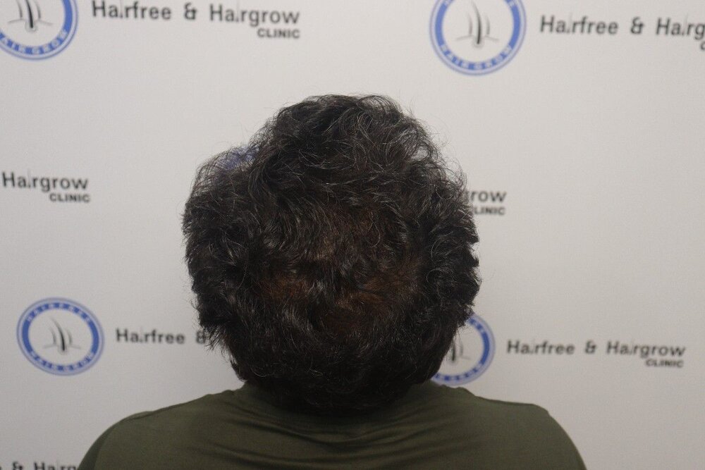 Result after 8 months.JPG