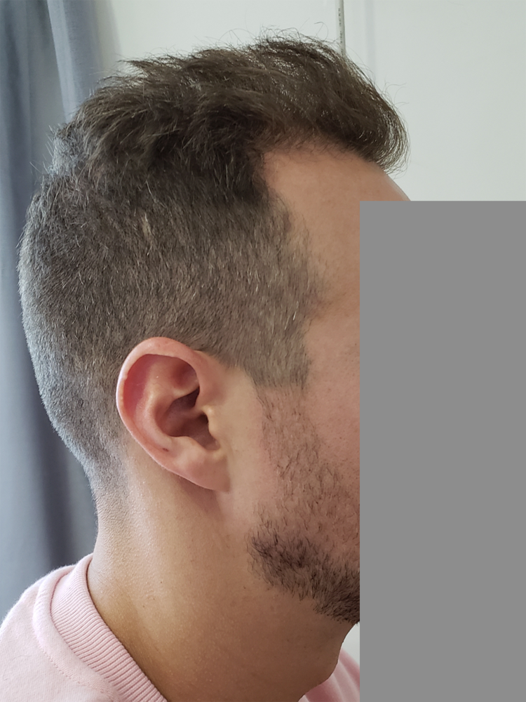 right side of hair copy.png