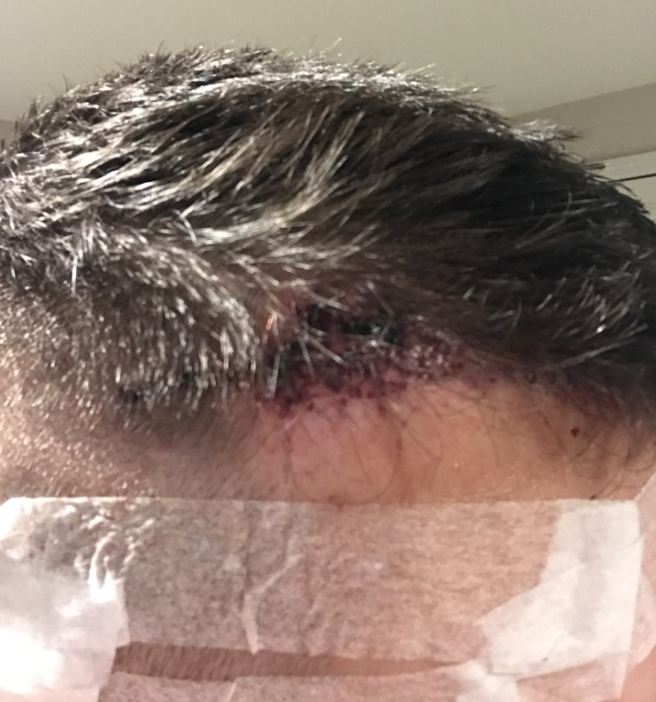 RightSide Revision day1.png