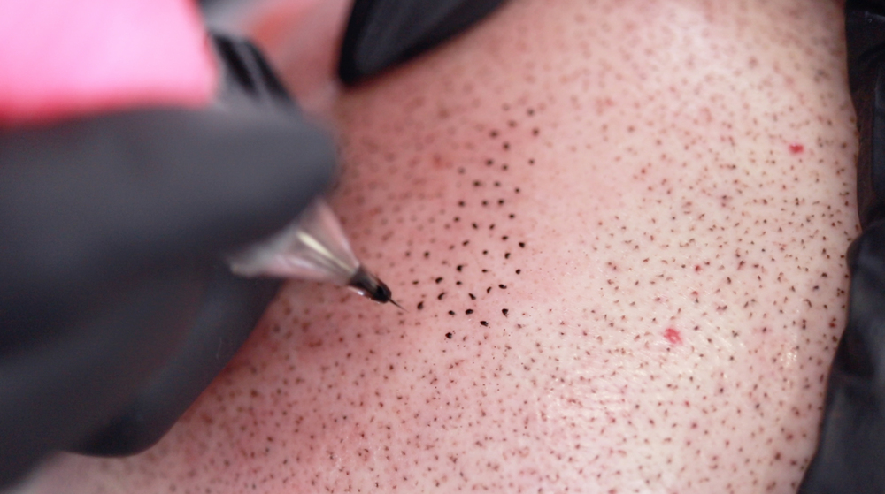 scalp-tattoo-unyozibeauty.jpg