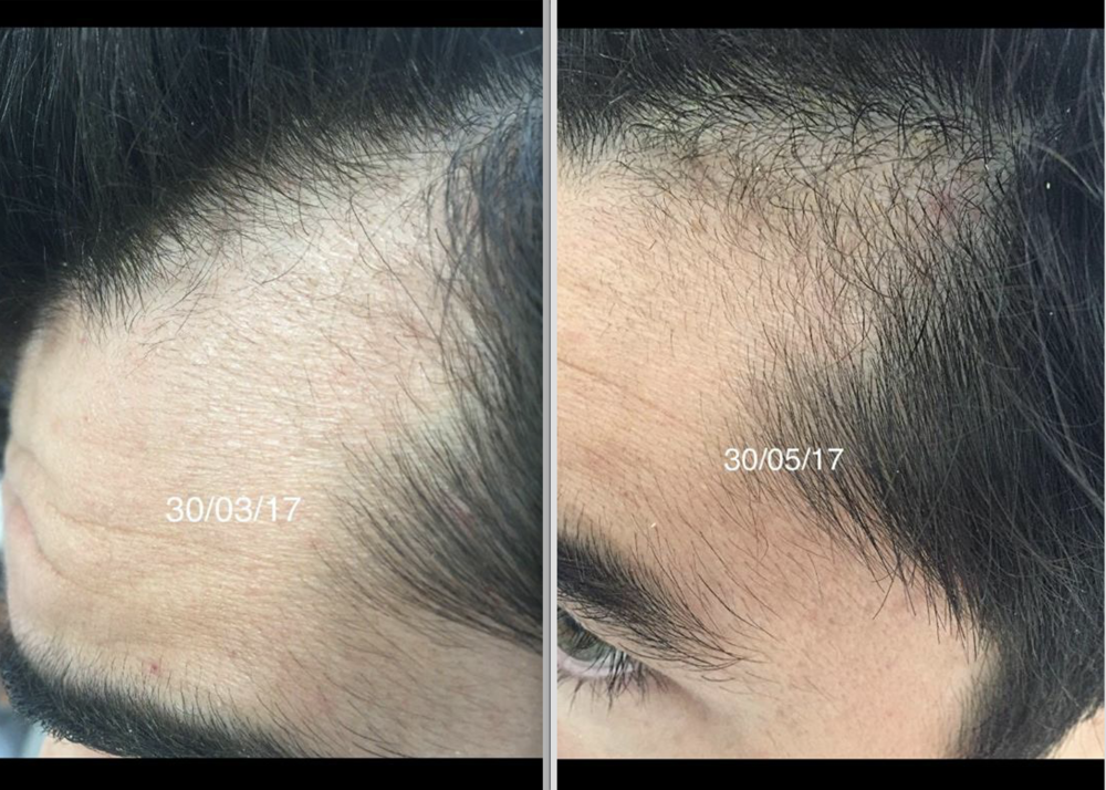 Screen Shot 2018-04-16 at 18.24.54.png