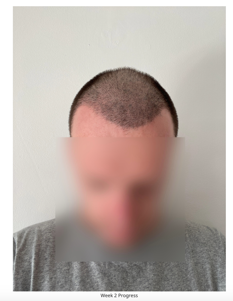 Screenshot 2020-08-27 at 22.48.26.png