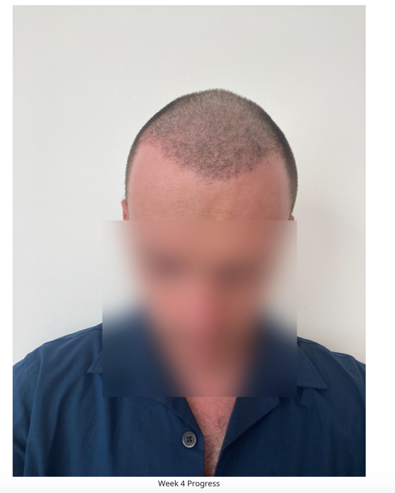 Screenshot 2020-08-27 at 22.48.38.png