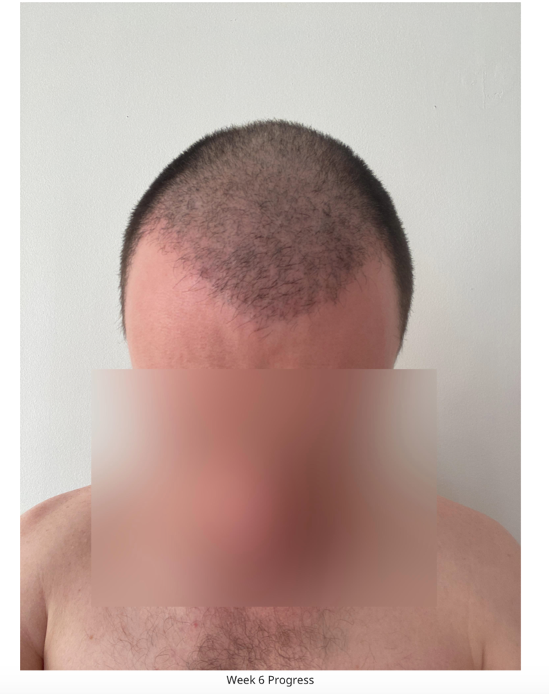 Screenshot 2020-08-27 at 22.48.49.png