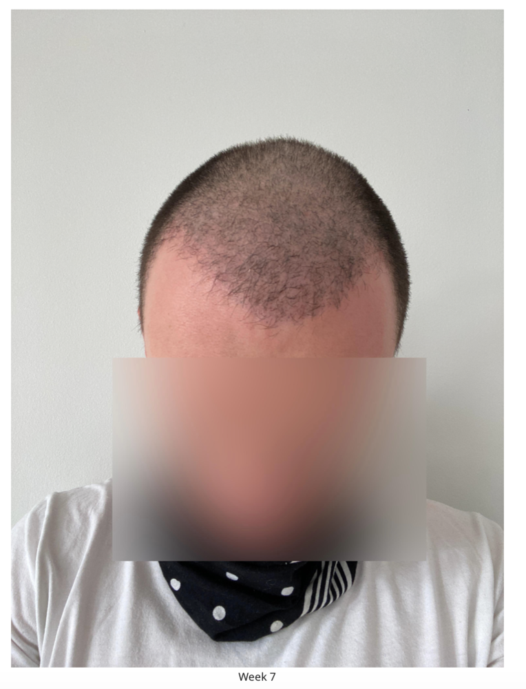 Screenshot 2020-08-27 at 22.48.56.png