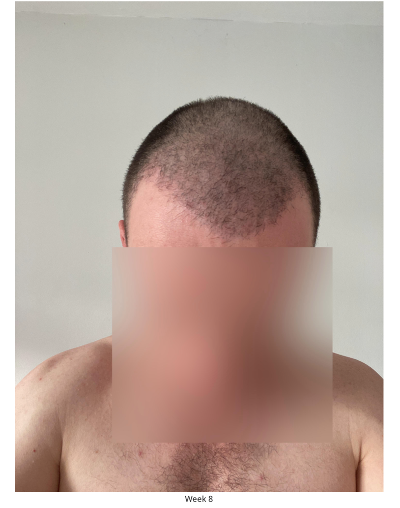 Screenshot 2020-08-27 at 22.49.02.png