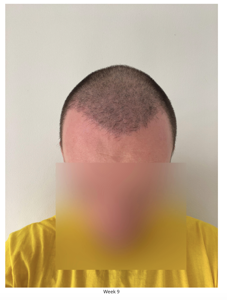 Screenshot 2020-08-27 at 22.49.08.png