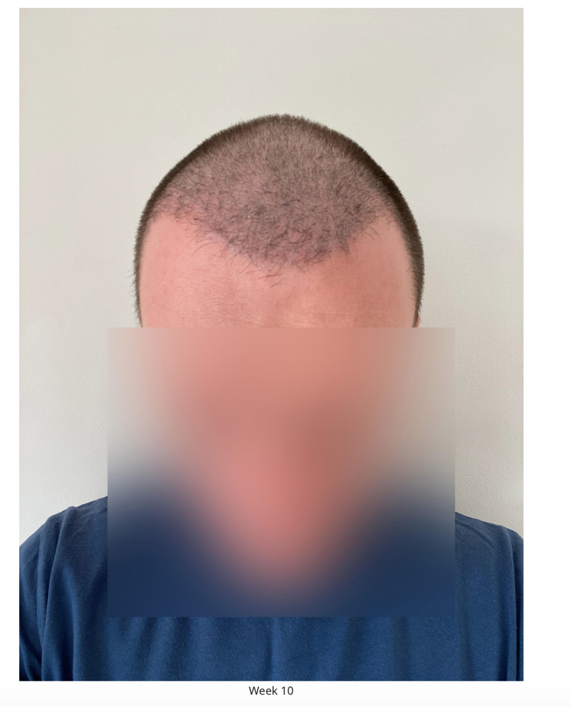 Screenshot 2020-08-27 at 22.49.14.png