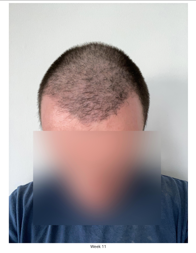 Screenshot 2020-08-27 at 22.49.19.png