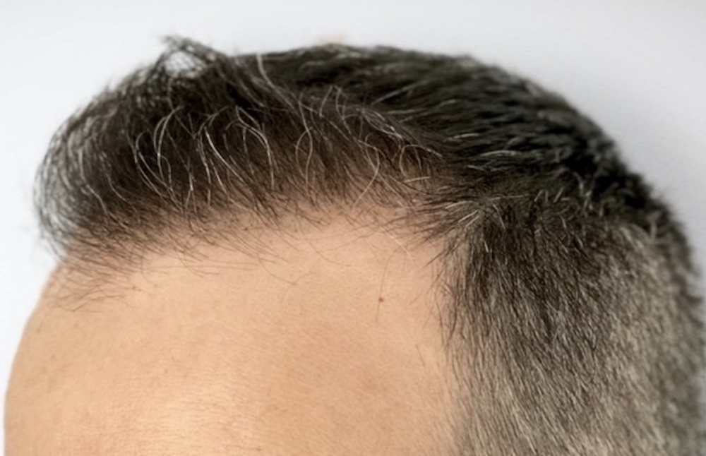 Screenshot 2024-07-28 at 19.32.21.png