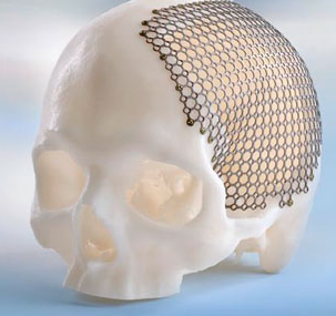 Skull-mesh.png