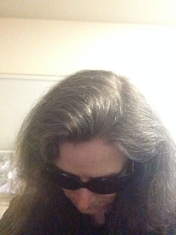 starting nine week juncture of laser comb.JPG