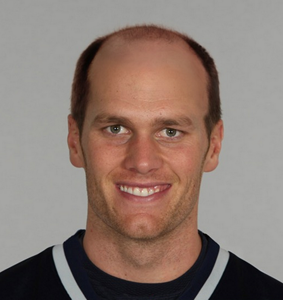 tom-brady-bald-1.png