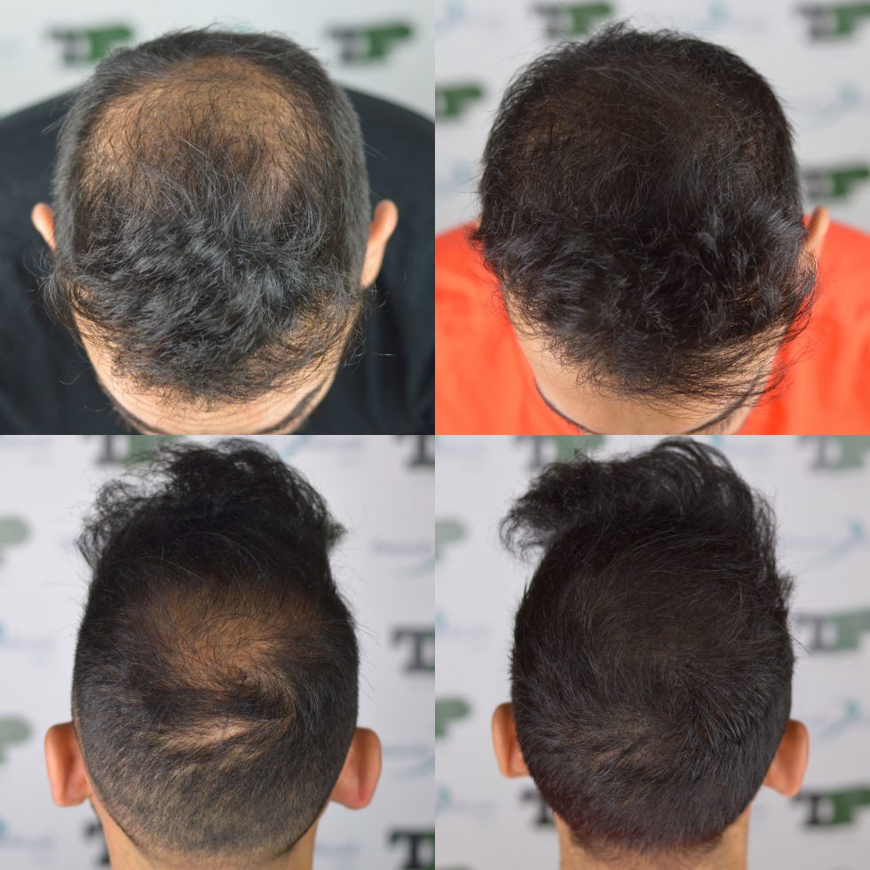 tricodensita%CC%80-980x980.jpg
