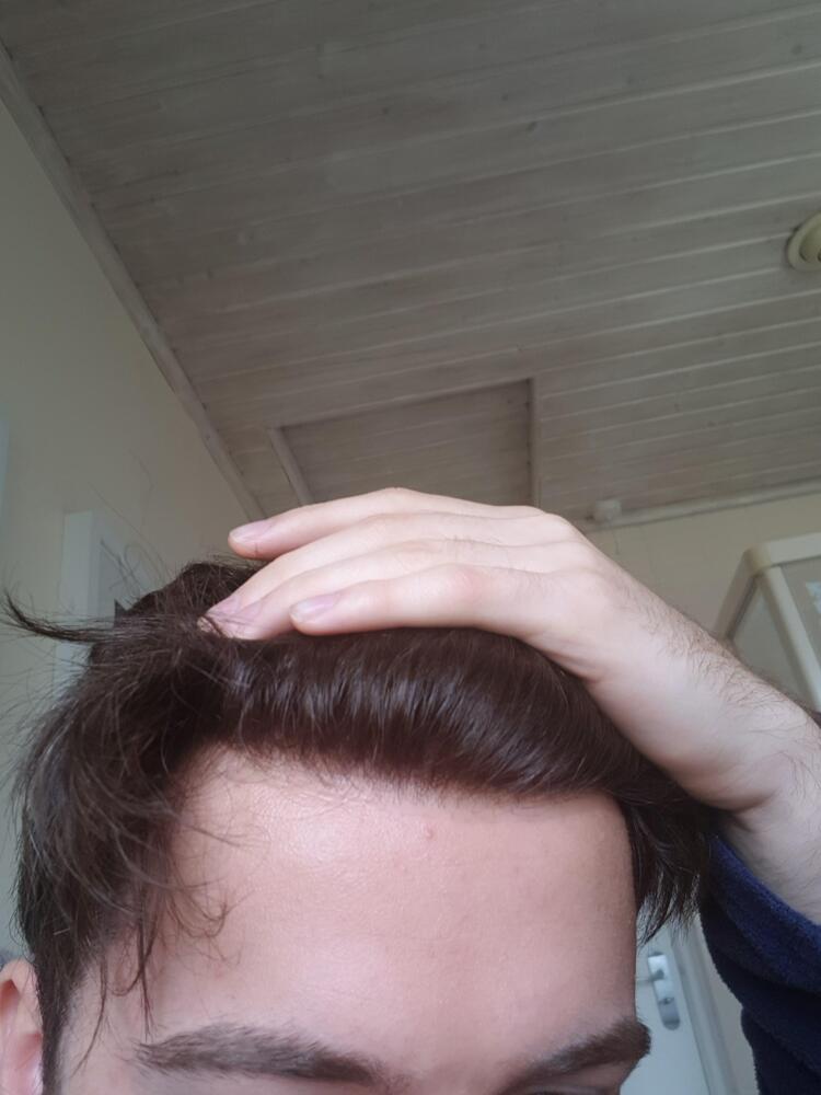 VcYEBaS.jpg