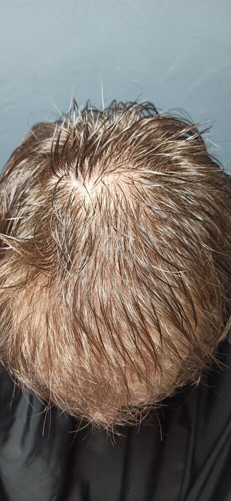 Wet Edit for Reddit.jpg