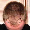 HairLossTalk.com pic.jpg