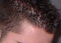 hairline.jpg