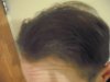 HairLossTalk.com 014.jpg