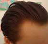 HairLossTalk.com 036.jpg