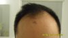 Hairline_201305.jpg