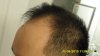 Hairline left_201305.jpg