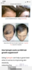 B918308E-00A9-4B0E-A2CB-02D3AA6A2CFE.png