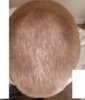 hairlosstalkupdate2new.jpg