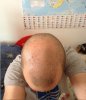 February 2014 - Shaved head.jpg