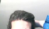 hairline.JPG