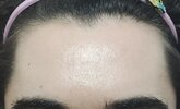 Hairline Peak results (Month 7).jpg