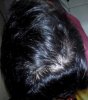 1 month finasteride - Dry Hair.jpg