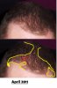 2 Hair loss beginning.jpg