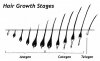 Hair_growth_stages_70132103.jpg