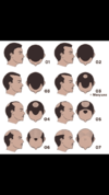 DBC6F081-B694-446D-9923-3A0A1845770A.png